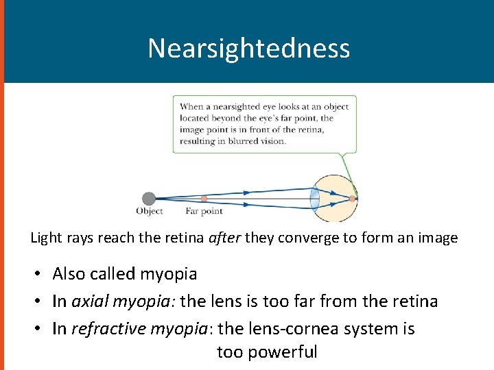 Nearsightedness Light rays reach the retina after they converge to form an image •