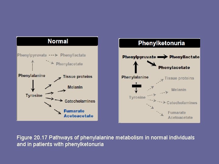 Figure 20. 17 Pathways of phenylalanine metabolism in normal individuals and in patients with