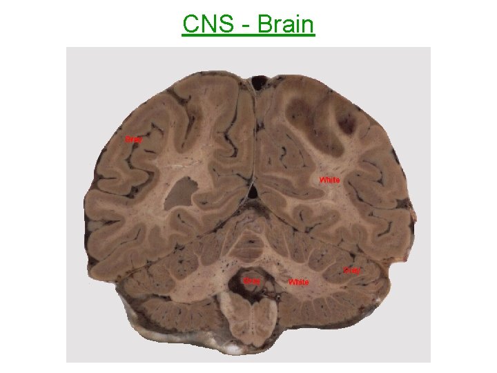 CNS - Brain 
