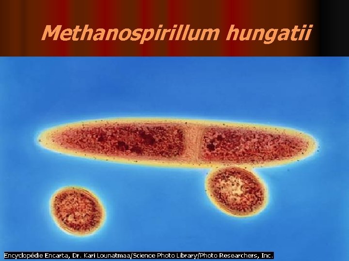 Methanospirillum hungatii 