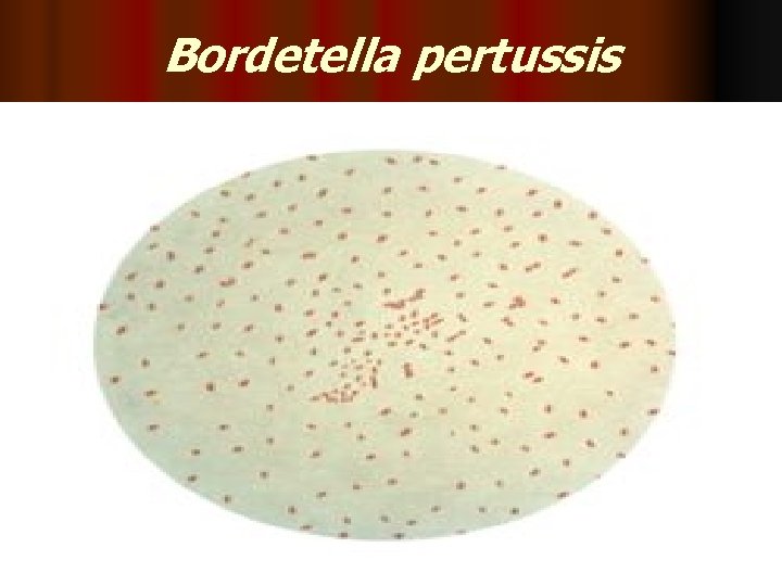 Bordetella pertussis 