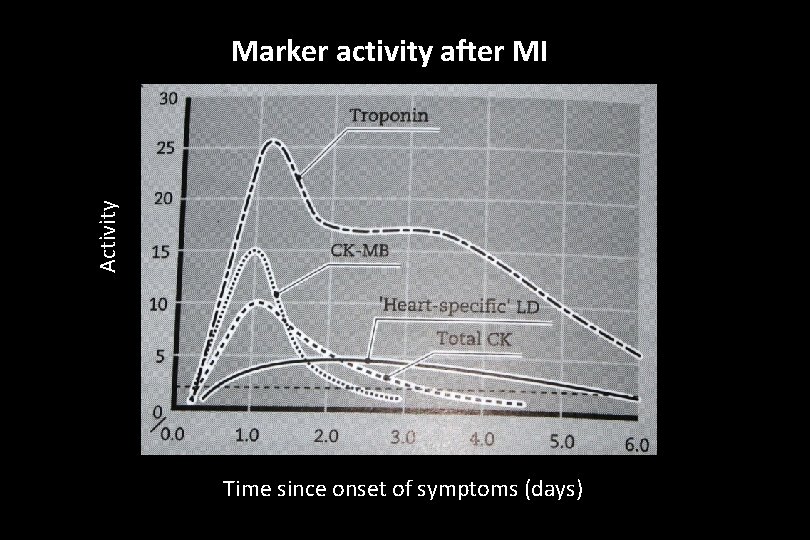 Activity Marker activity after MI Time since onset of symptoms (days) 