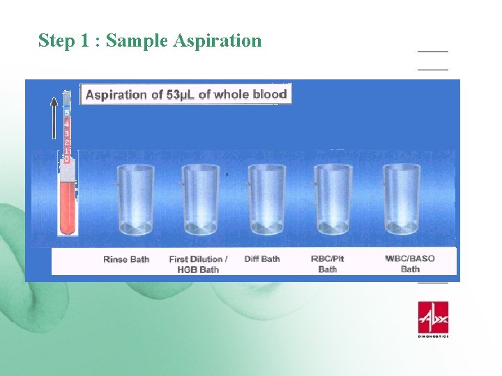 Step 1 : Sample Aspiration 