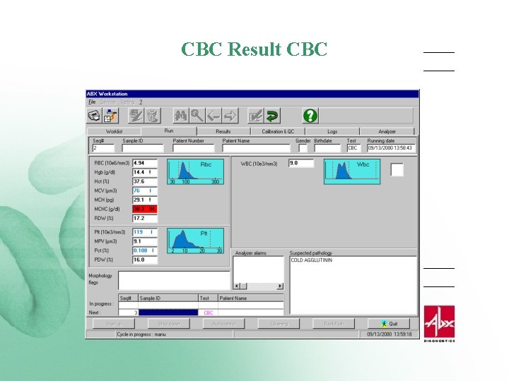 CBC Result CBC 