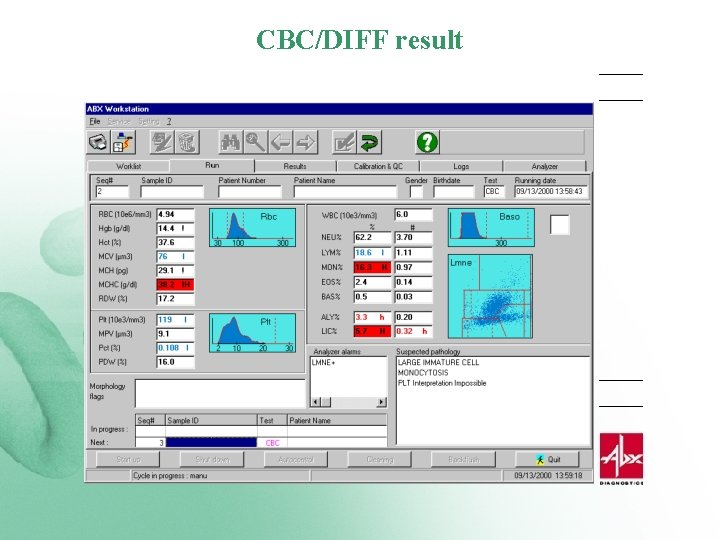 CBC/DIFF result 