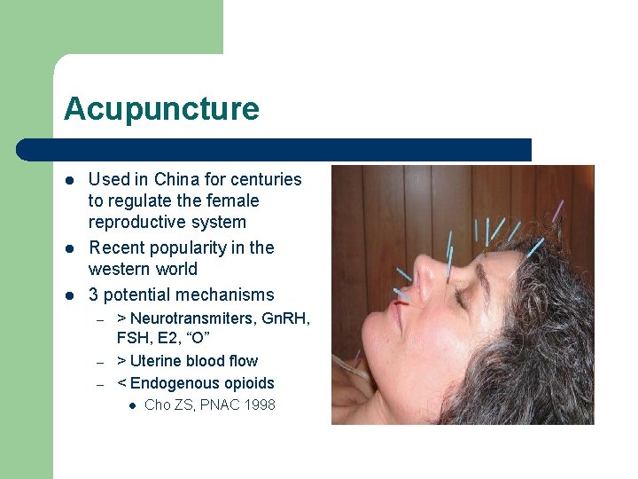 Acupuncture l l l Used in China for centuries to regulate the female reproductive