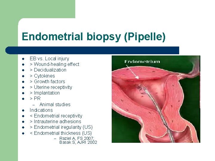 Endometrial biopsy (Pipelle) l l l l EB vs. Local injury > Wound-healing effect
