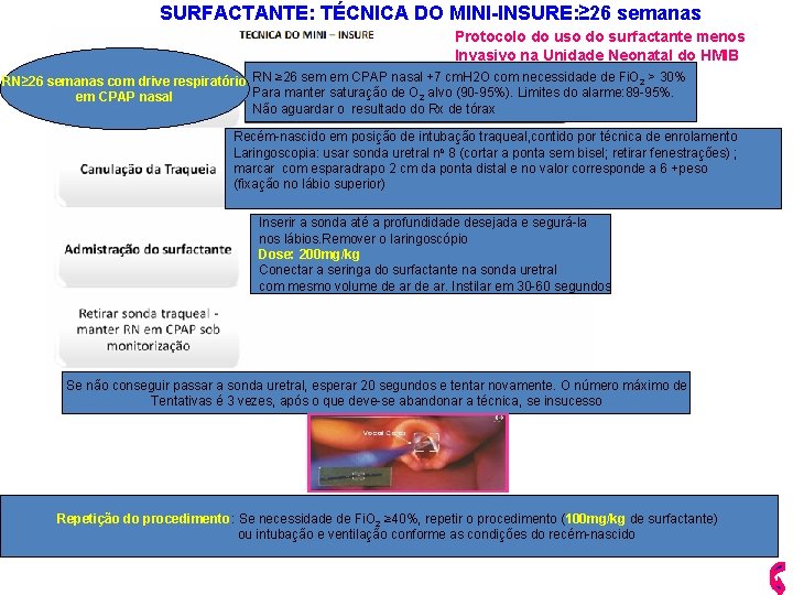 SURFACTANTE: TÉCNICA DO MINI-INSURE: ≥ 26 semanas Protocolo do uso do surfactante menos Invasivo