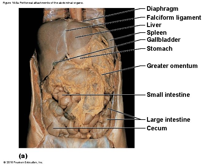Figure 14. 5 a Peritoneal attachments of the abdominal organs. Diaphragm Falciform ligament Liver