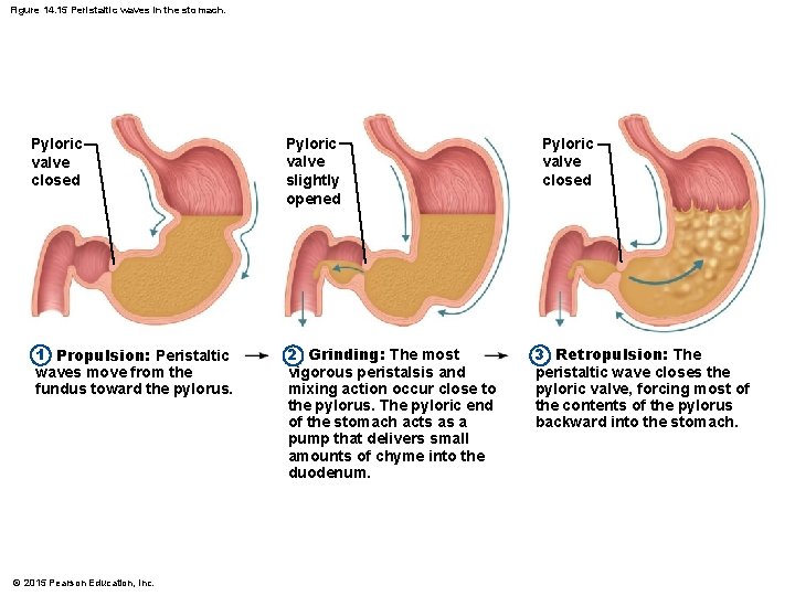 Figure 14. 15 Peristaltic waves in the stomach. Pyloric valve closed Pyloric valve slightly