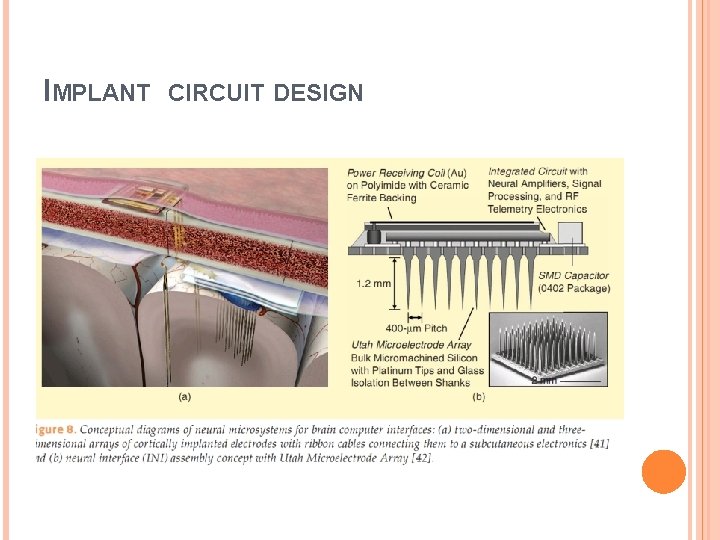 IMPLANT CIRCUIT DESIGN 