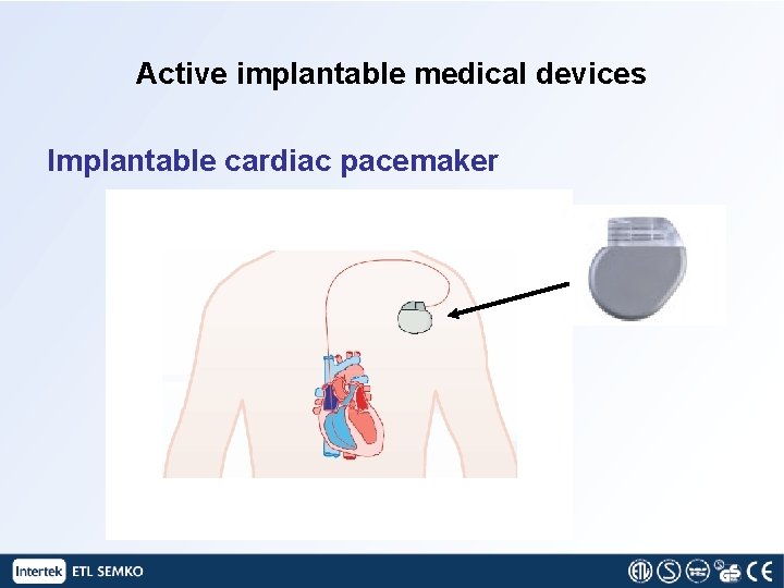 Active implantable medical devices Implantable cardiac pacemaker 