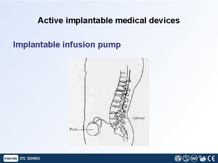 Active implantable medical devices Implantable infusion pump 