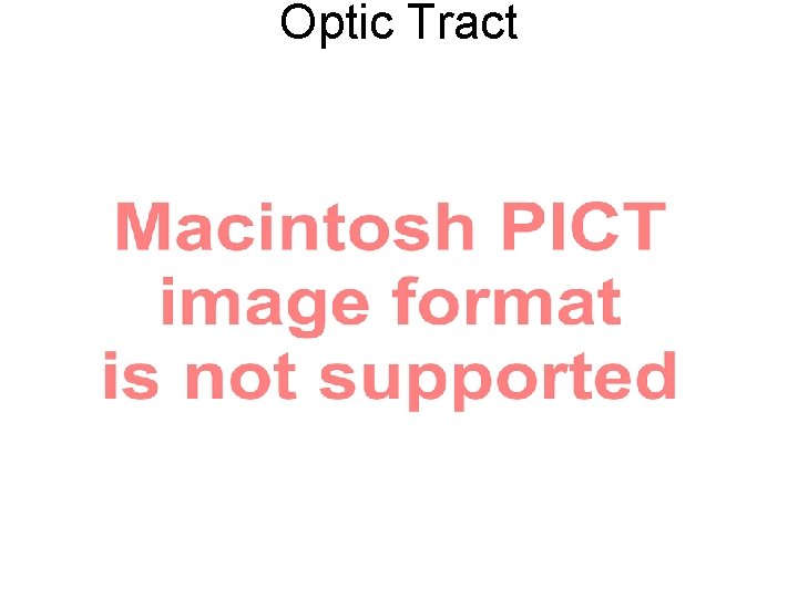 Optic Tract 