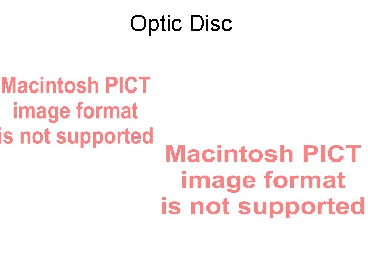 Optic Disc 