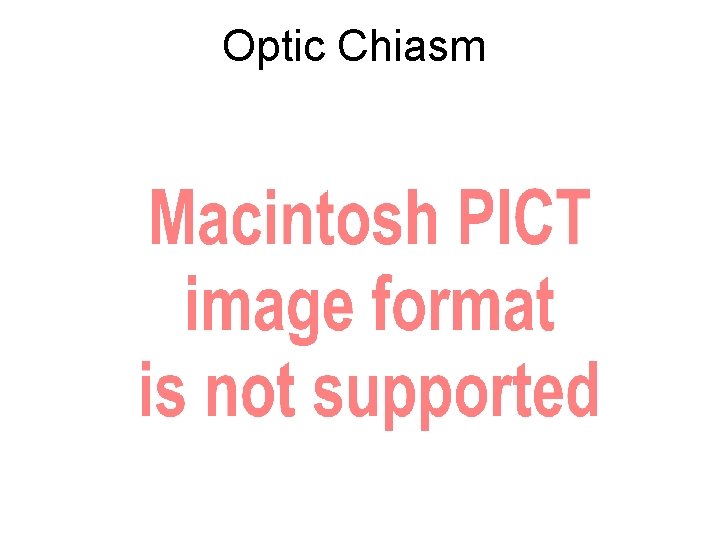 Optic Chiasm 