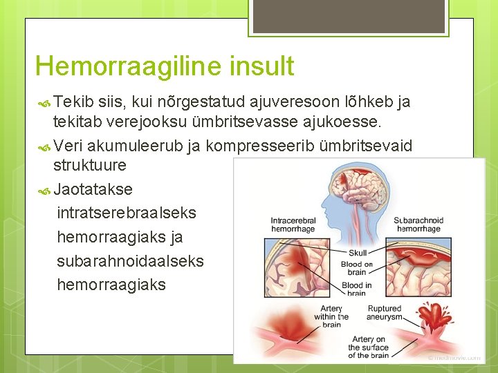 Hemorraagiline insult Tekib siis, kui nõrgestatud ajuveresoon lõhkeb ja tekitab verejooksu ümbritsevasse ajukoesse. Veri Hemorraagiline insult Tekib siis, kui nõrgestatud ajuveresoon lõhkeb ja tekitab verejooksu ümbritsevasse ajukoesse. Veri