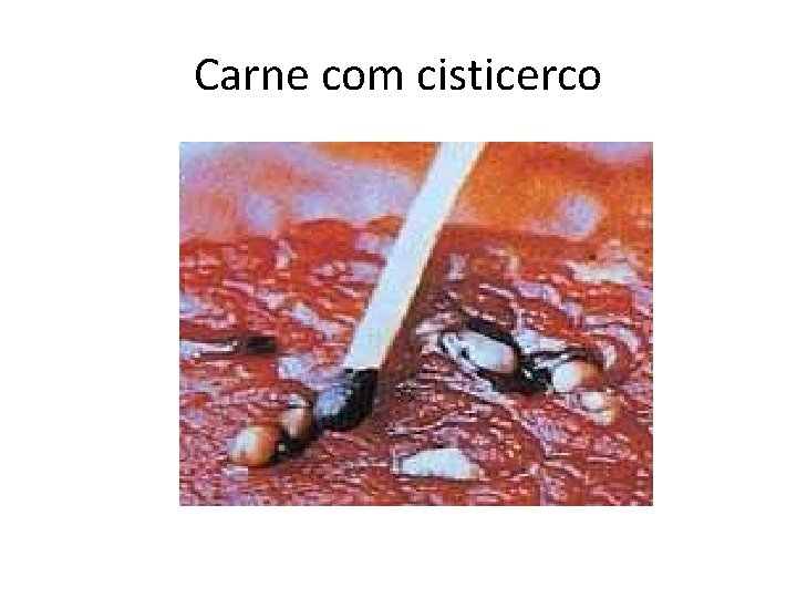 Carne com cisticerco 