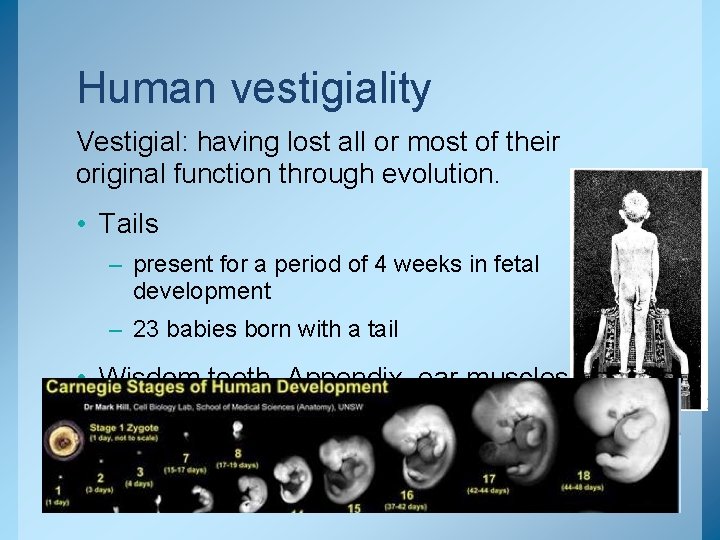 Human vestigiality Vestigial: having lost all or most of their original function through evolution.