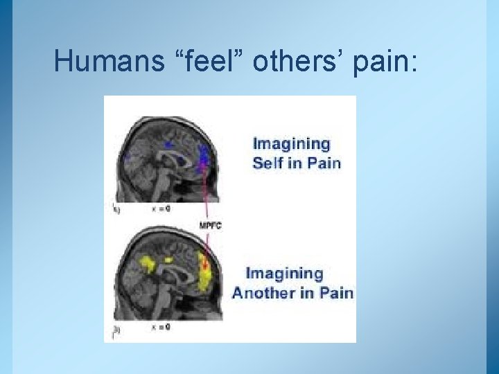 Humans “feel” others’ pain: 