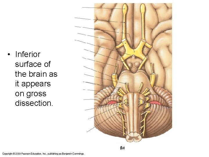  • Inferior surface of the brain as it appears on gross dissection. 