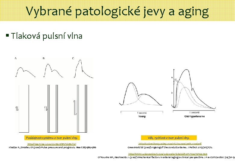 Vybrané patologické jevy a aging § Tlaková pulsní vlna Poddajnost systému a tvar pulsní