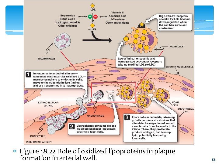  Figure 18. 22 Role of oxidized lipoproteins in plaque formation in arterial wall.