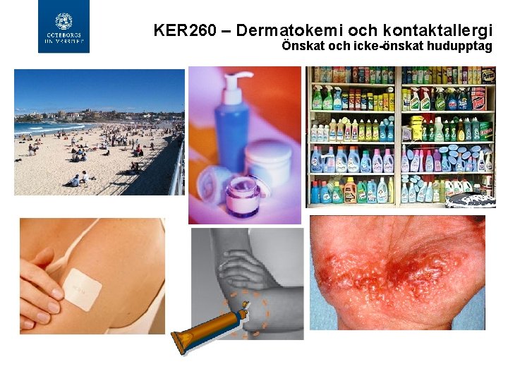 KER 260 – Dermatokemi och kontaktallergi Önskat och icke-önskat hudupptag 