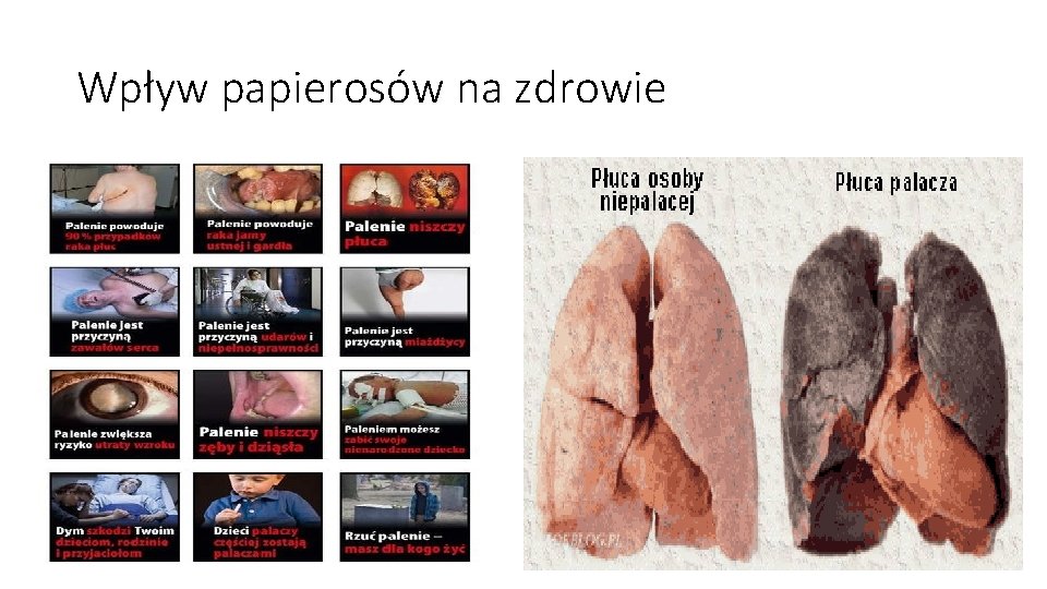 Wpływ papierosów na zdrowie 