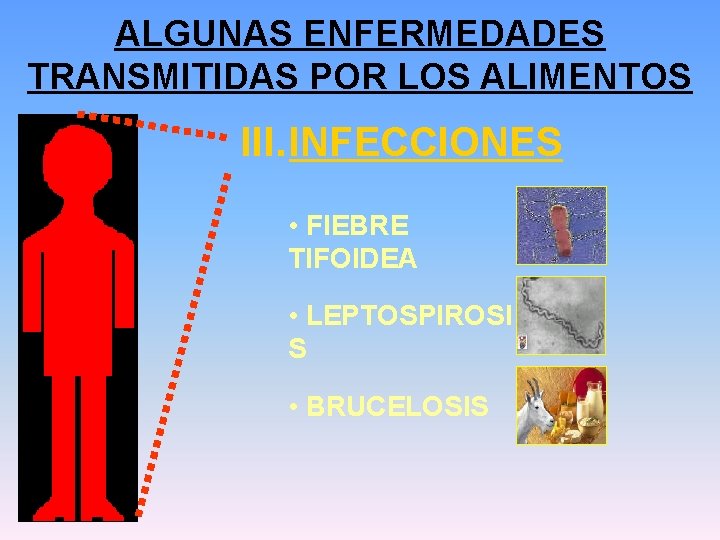 ALGUNAS ENFERMEDADES TRANSMITIDAS POR LOS ALIMENTOS III. INFECCIONES • FIEBRE TIFOIDEA • LEPTOSPIROSI S