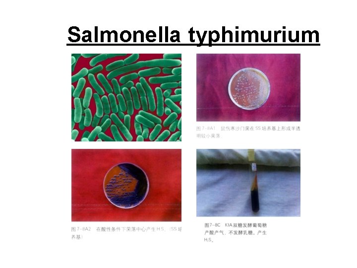 Salmonella typhimurium 