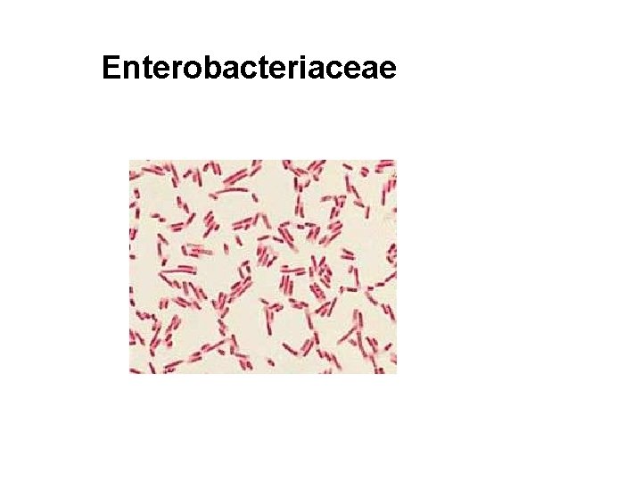 Enterobacteriaceae 