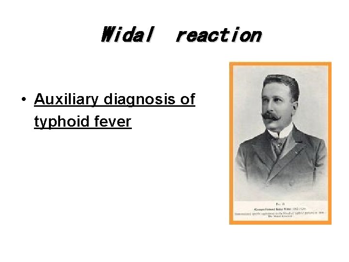 Widal reaction • Auxiliary diagnosis of typhoid fever 