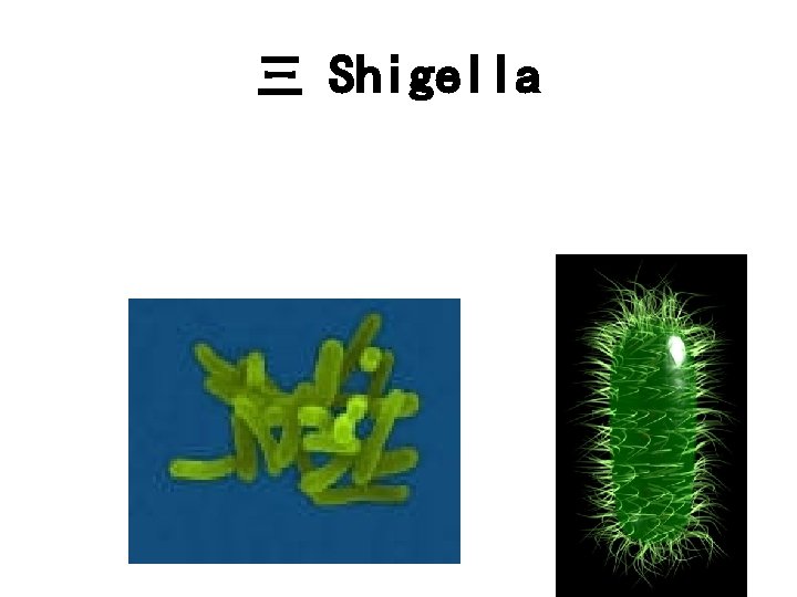 三 Shigella 