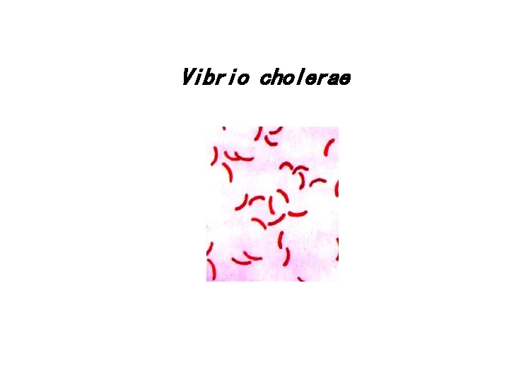 Vibrio cholerae 