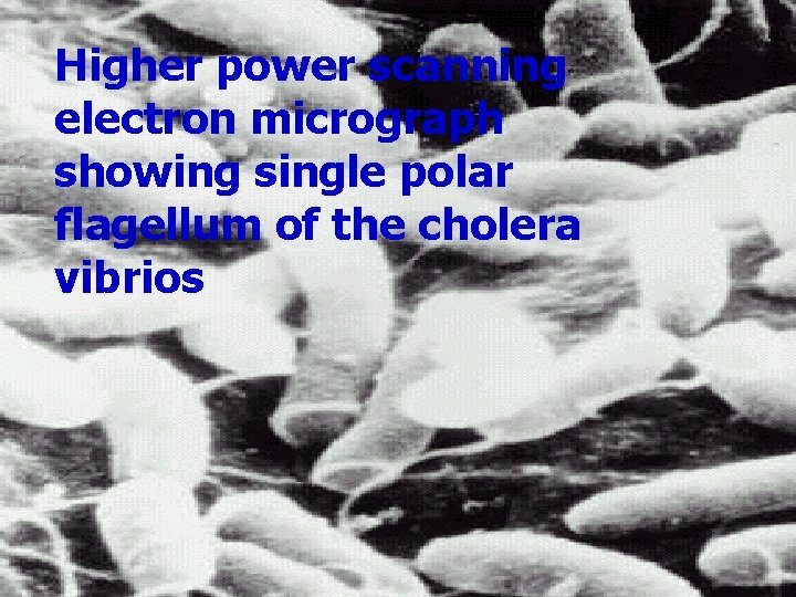 Higher power scanning electron micrograph showing single polar flagellum of the cholera vibrios 