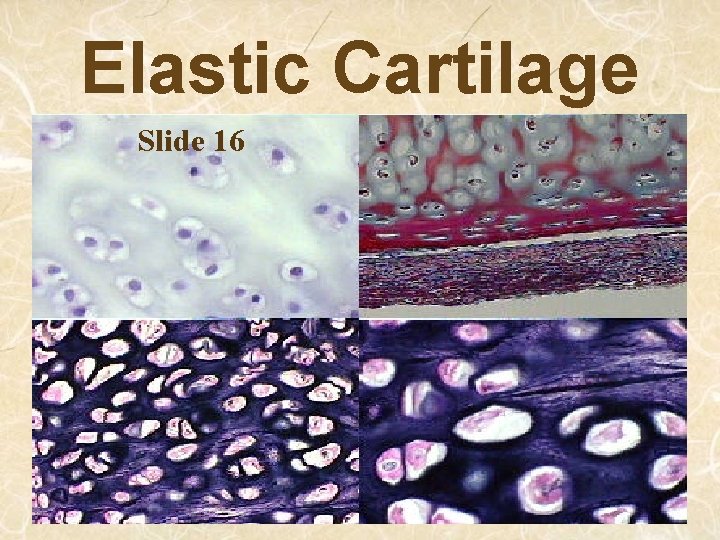 Elastic Cartilage Slide 16 