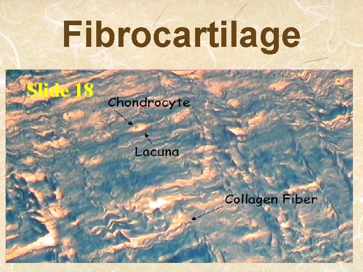 Fibrocartilage Slide 18 
