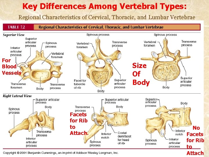 Key Differences Among Vertebral Types: Regional Characteristics of Cervical, Thoracic, and Lumbar Vertebrae For