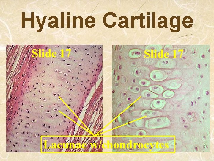 Hyaline Cartilage Slide 17 Lacunae w/chondrocytes 
