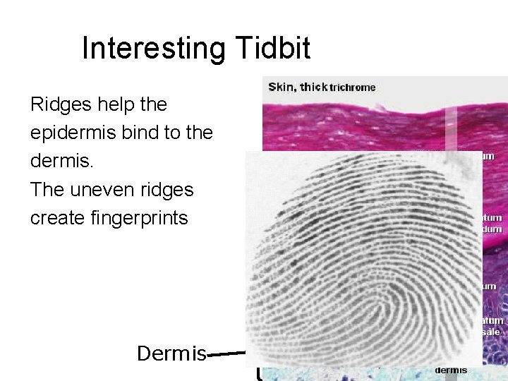 Interesting Tidbit Ridges help the epidermis bind to the dermis. The uneven ridges create