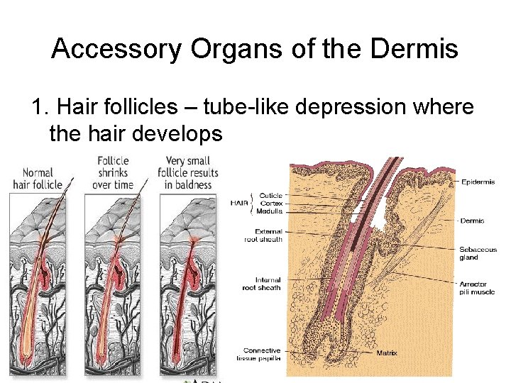 Accessory Organs of the Dermis 1. Hair follicles – tube-like depression where the hair