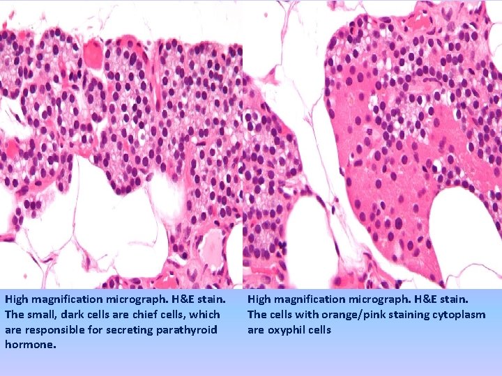 High magnification micrograph. H&E stain. The small, dark cells are chief cells, which are