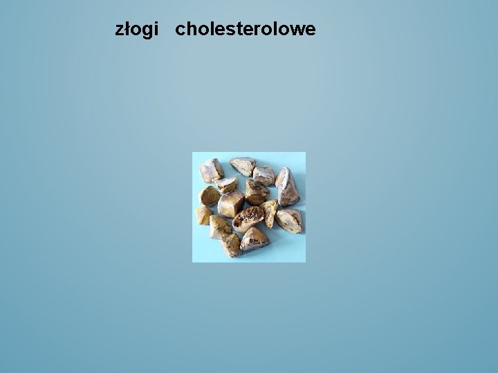 złogi cholesterolowe 