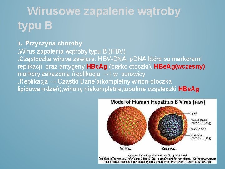 Wirusowe zapalenie wątroby typu B 1. Przyczyna choroby Wirus zapalenia wątroby typu B (HBV)