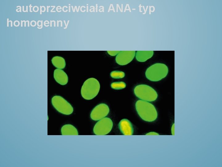 autoprzeciwciała ANA- typ homogenny 