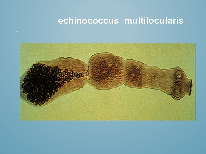 echinococcus multilocularis 