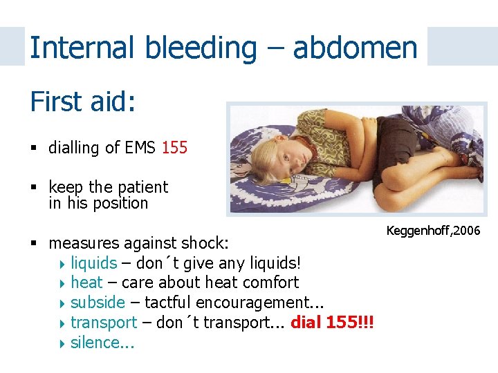 Internal bleeding – abdomen First aid: dialling of EMS 155 keep the patient in