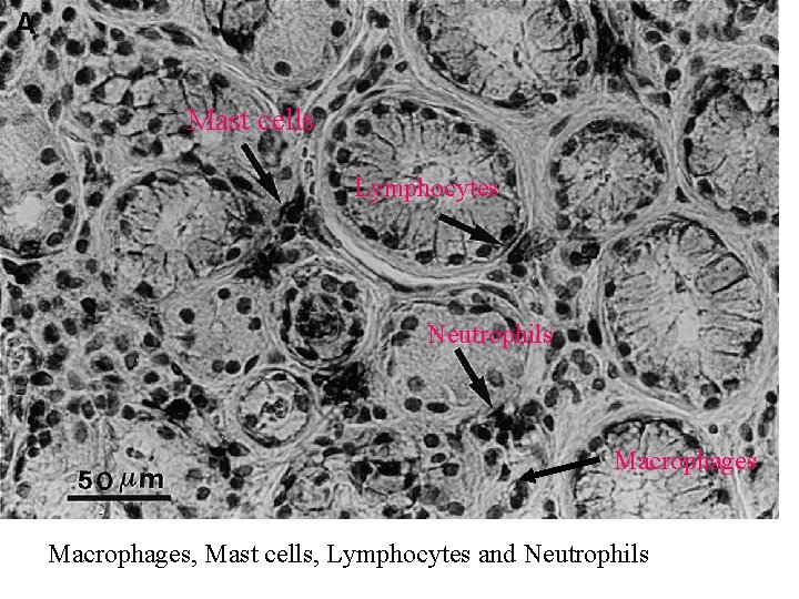 Mast cells Lymphocytes Neutrophils Macrophages, Mast cells, Lymphocytes and Neutrophils 