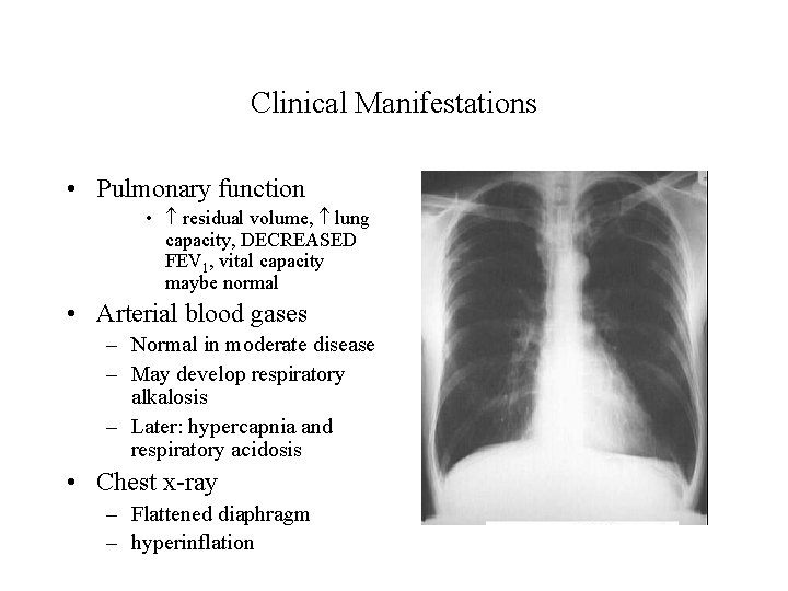 Clinical Manifestations • Pulmonary function • residual volume, lung capacity, DECREASED FEV 1, vital